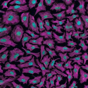 Human cervical cancer cells